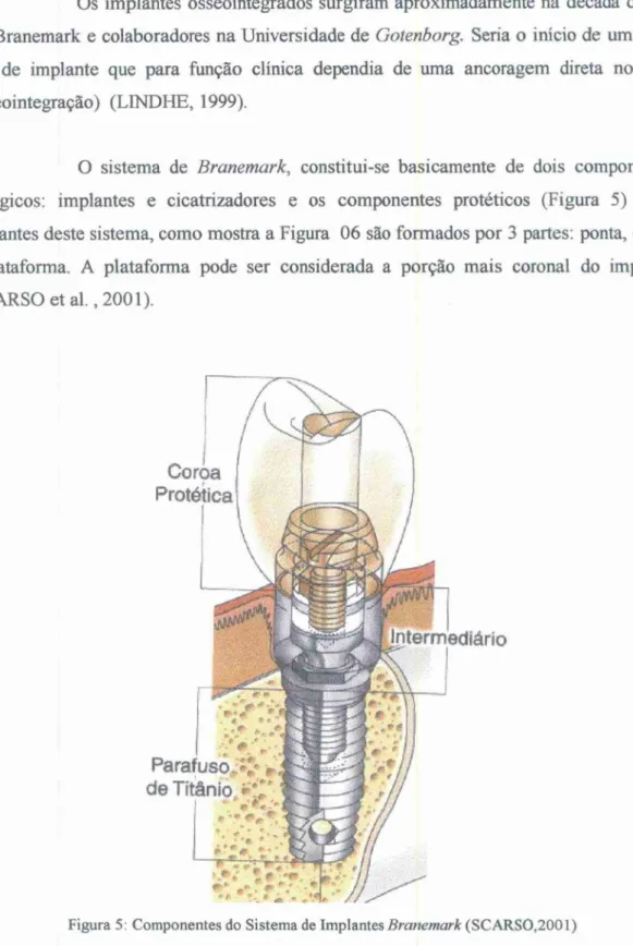 Figura  5:  Componentes do Sistema de Implantes  Branemark  (SCARS0,2001) 