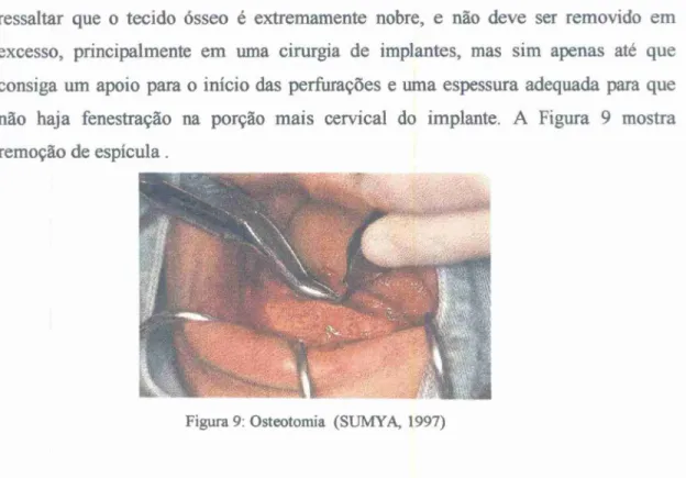Figura  9: Osteotomia (SUMYA, 1997) 