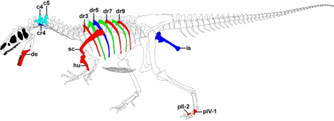 Figure 1 Overview of pathologies in SMA 0005. Skeletal reconstruction of SMA 0005, showing all pathologic bones
