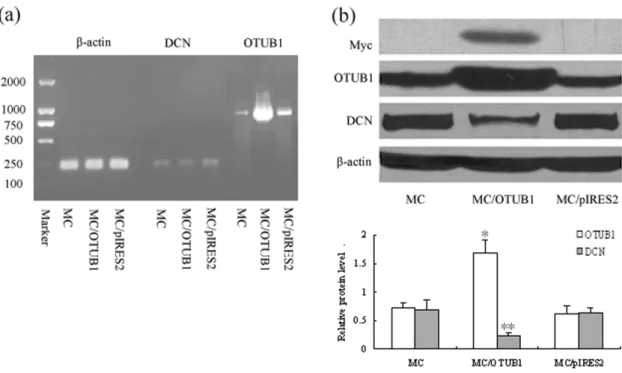 Figure 4. OTUB1 expression in glomerular during some golmerulonephritides was detected by immunohistochemistry