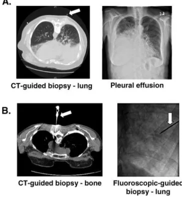 Figure 1. Re-Biopsy Studies