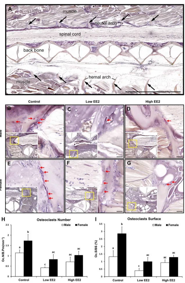 Figure 9. Representative histology pictures of TRAP staining for detection of osteoclasts in both sexes of Japanese medaka O.