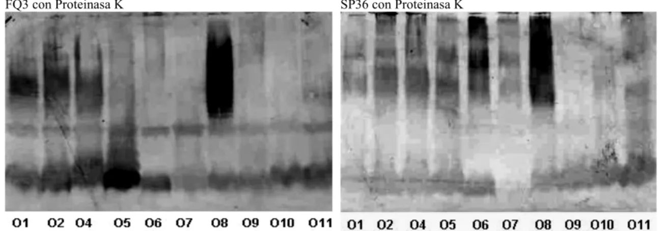 Figura 4. Western blot de 10 cepas de Pseudomonas aeruginosa para evaluar el reconocimiento hacia LPS por parte de los sueros FQ3  (paciente con fibrosis quística) y suero SP36 (paciente con sepsis nosocomial), con alto reconocimiento hacia exotoxina A, pr