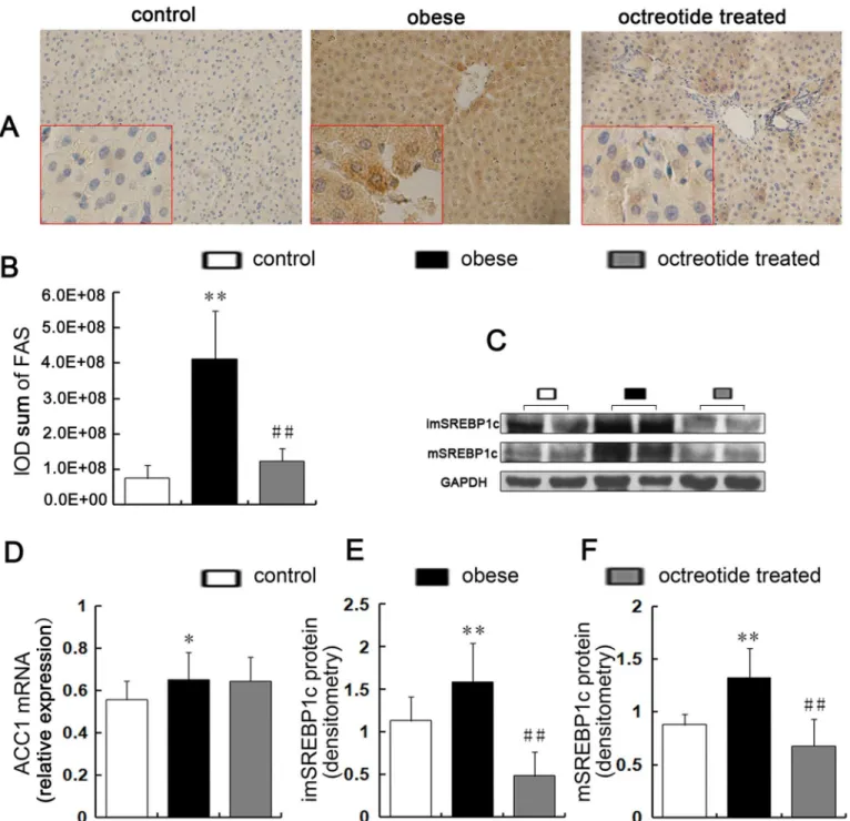 Fig 2. Expression of key factors related to hepatic lipogenesis synthesis. The positive expression of FAS is indicated by brown granules (A,