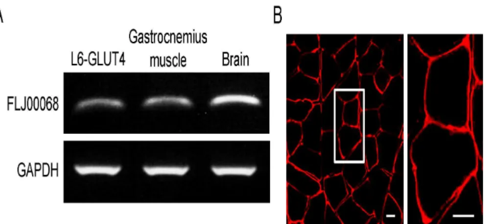 Fig 1. The expression of FLJ00068 in mouse gastrocnemius muscle. (A) Expression levels of FLJ00068 and GAPDH in L6-GLUT4 cells, mouse gastrocnemius muscle, and the mouse brain were assessed by RT-PCR.
