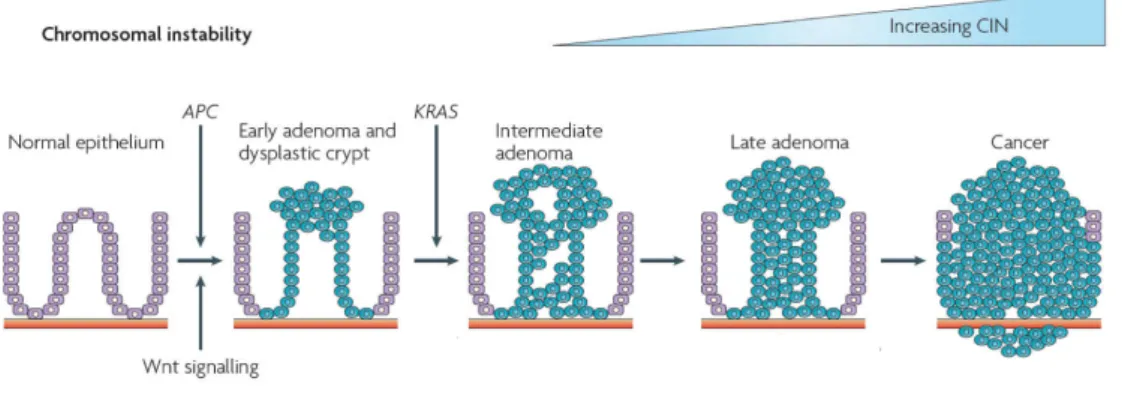 Figure 1.2 – The adenoma-carcinoma sequence: main histological and molecular alterations in each stage of  sporadic colon cancer progression (adapted from [14])