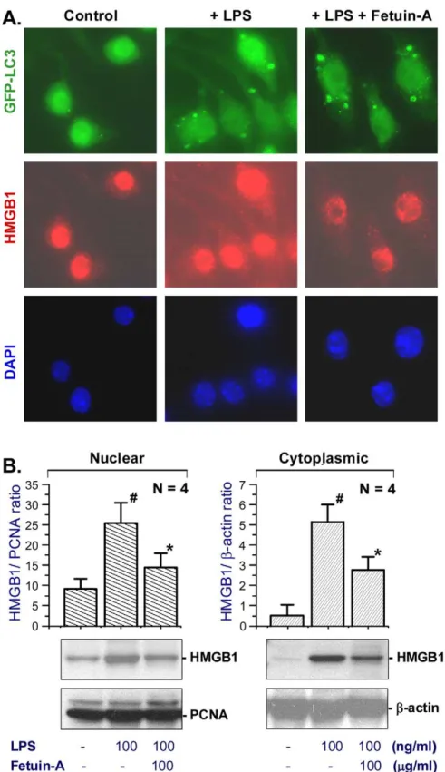 Figure 5. Fetuin-A did not affect LPS-induced formation of LC3-containing cytoplasmic vesicles, but attenuated cytoplasmic HMGB1 levels