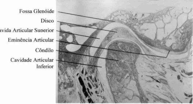 Figura 1  -  Corte histológico da articulação temporomandibular. 