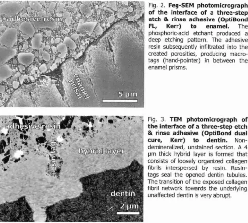 Fig. 2.  Feg-SEM photomicrograph  of the interface of a three-step  etch &amp; rinse adhesive (OptiBond  FL, Kerr) to enamel