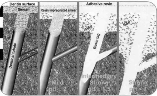 Fig. 8  Schematic overview of the interaction of different self-etch adhesives with  dentin  (bar at the left represents approximately 5 pm)