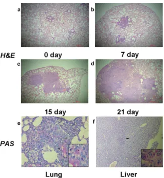 Fig 3. Lung sections of mice infected with T. marneffei. Progressive inflammatory reaction presented with leukocyte infiltration and granuloma formation with tissue destruction, HE-stains 100X (a-d).