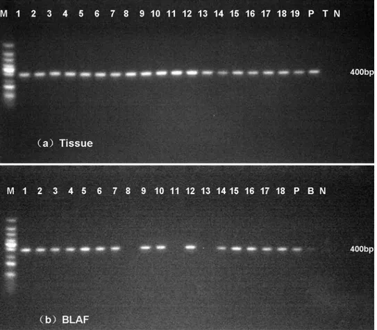 Fig 5. Nested PCR assays in fresh lung tissues (a) and BALF (b). A 400-bp specific product was amplified in most of samples