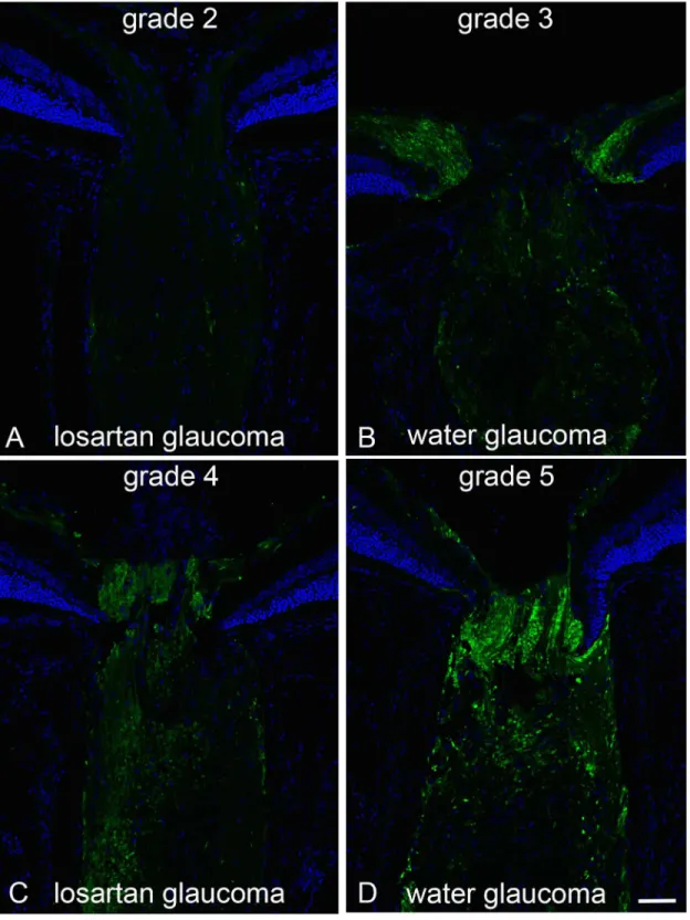Fig 2. Axonal transport effects, APP labeling with losartan-treated vs water control. Immunolabeling for APP in the optic nerve head of mice treated with oral losartan (A and C) and water alone (B and D) shows axonal transport obstruction 3 days after IOP 