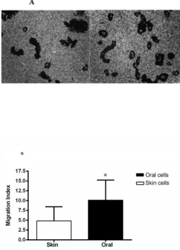 Figure 5. Comparison of skin and oral keratinocyte migration by Gold-Colloidal Migration Assay
