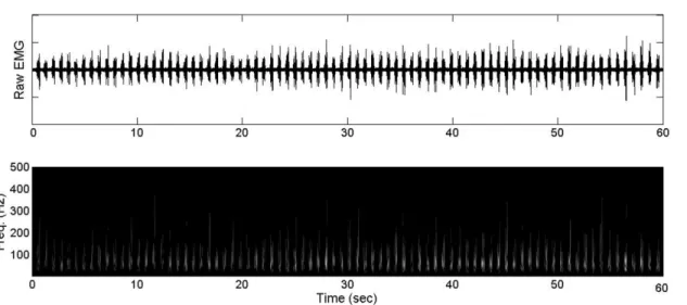 Fig 1. Exemplar raw EMG data as well as Morlet continuous wavelet transforms across one entire 60 second interval.