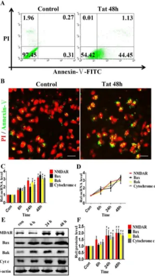 Figure 3. HIV-1 Tat induces apoptosis in RPE cells. ARPE-19 cells were incubated with or without 200 ng/ml Tat for 48 hours.