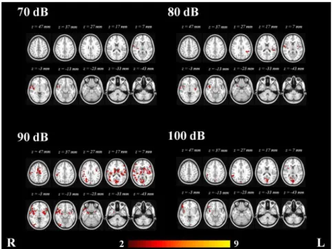 Table 3. Clusters with maximal covariance with N1/P2 amplitudes at 70, 80, 90 and 100 dB in the fMRI data analysis
