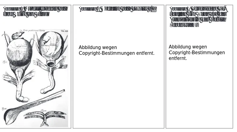 Abbildung 3:  Verschiedene Vor- Vor-schläge von Virag [3] der Arterialisierung des penilen Venensystems