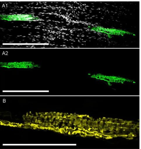 Fig 8. Confocal imaging of YFP expression in skeletal muscle spindles. A1, YFP-expressing muscle spindles in deep tissue of tibialis anterior skeletal muscle