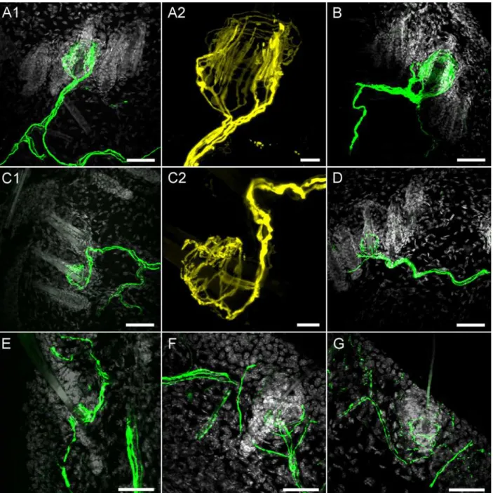 Fig 7. Confocal imaging of YFP expression in hairy skin nerve terminals. A1, A2 and B, YFP-expressing longitudinal lanceolate endings innervating hair on dorsal skin