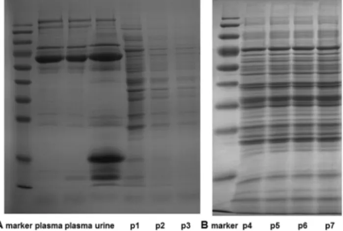 Figure 1. SDS-PAGE analysis of perfusion-driven urine. (A) The proteins from the perfusion-driven urine with oxygen supplementation were resolved and compared with the proteins present in rat plasma and rat urine