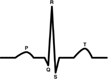 Figure    1: An ECG Beat. 