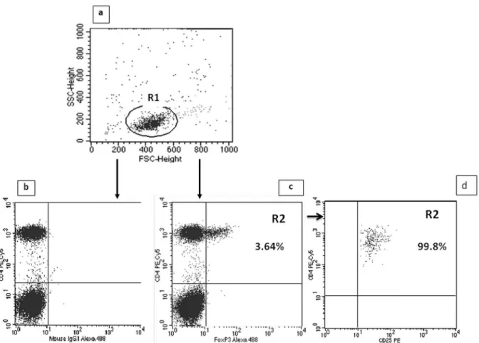 Fig 2. Evaluation of CD4 + CD25 high FoxP3 + (Treg) cells frequency in ALD patients by flow cytometry