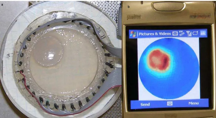 Figure 5. Breast cancer detection example. a) The DAD of the system with two types of gel representing a breast cancer tumor surrounded by normal breast tissue