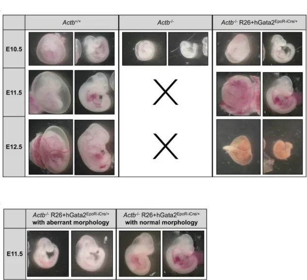 Figure 6. Actb2/2 R26+hGata2EpoR-iCre/+ embryos remain viable at E11.5. (A) Schematic view of the breeding scheme used to generate Gata2 expression in the erythroid lineage in Actb2/2 mice