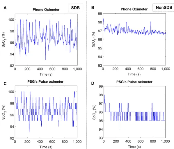 Figure 11. SpO 2 signal with different resolutions. An SpO 2 signal segment, recorded using the Phone Oximeter (0.1% resolution) for (A) SDB and (B) NonSDB children, and the corresponding SpO 2 signal recorded simultaneously with the PSG’s pulse oximeter (