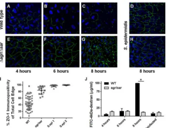 Fig 2. Exoprotein-dependent alterations in ZO-1 immunoreactivity of cultured human RPE cells infected with S