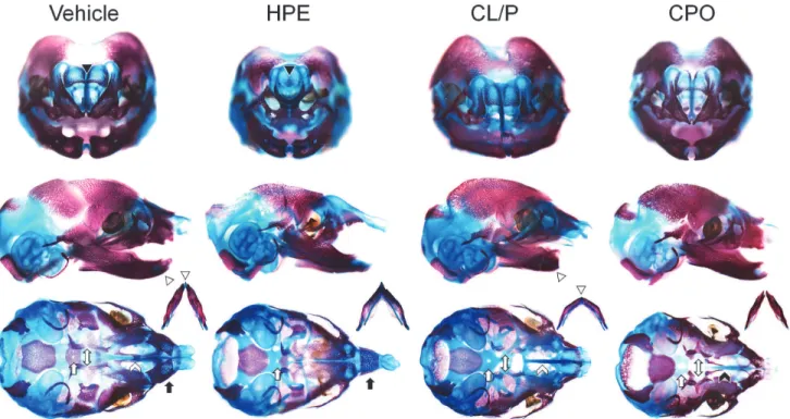 Fig 2. HPE, CL/P, and CPO associated craniofacial abnormalities. Bone and cartilage are stained red and blue, respectively