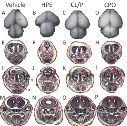 Fig 3. HPE, CL/P, and CPO associated brain morphology. Superior views of dissected brains are shown for a vehicle-exposed normal animal (A) and for representative examples of animals with vismodegib-induced HPE (B), cyclopamine-induced CL/P (C), and vismod