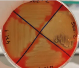 Figure  1.1.  Streptococcus  pyogenes  strains  grown  on  a  blood  agar  plate  with  observation  of  beta-hemolysis (This study)