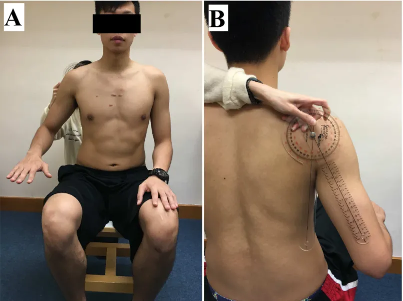 Fig 1. Example of the subject’s position for the measurement of upper trapezius muscle shear modulus during the active task at 30° of shoulder abduction