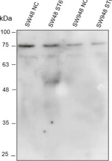 Figure 3.3 –ST6Gal-I expression at the protein level by CRC cell lines. Assessment by WB of the presence of ST6Gal I  protein in the cell lysates of the SW48 NC, SW48 ST6, SW948 NC and SW948 ST6 cell lines using the anti-ST6Gal-I Ab.