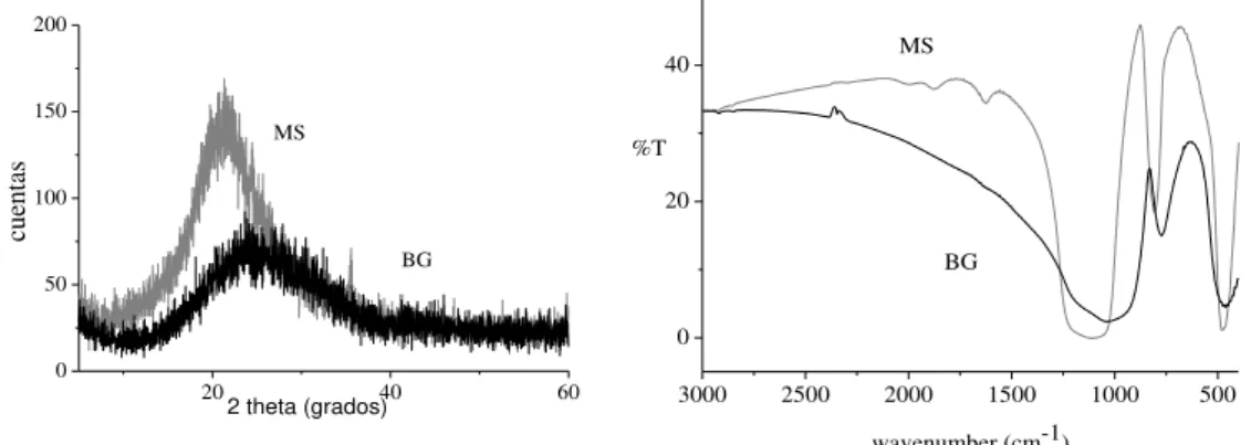 Figura 1: Difractograma y espectro IR de las adiciones MS y BG 