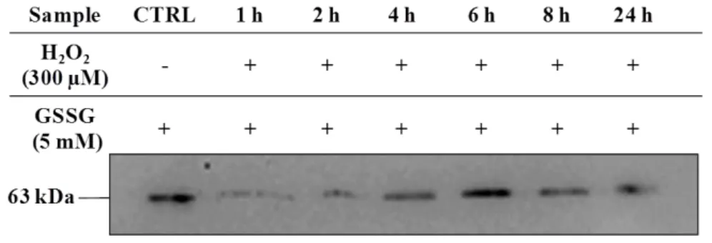 Fig.  4.3  -  Protein  glutathionylation  profile  of  SK-N-MC  cells  submitted  to  oxidative  injury  (300  µM  H 2 O 2 )  with  different times of exposure (o-24 h), in comparison to (A) control (CTRL), as well as  (B) oxidized samples with 5  mM GSSG