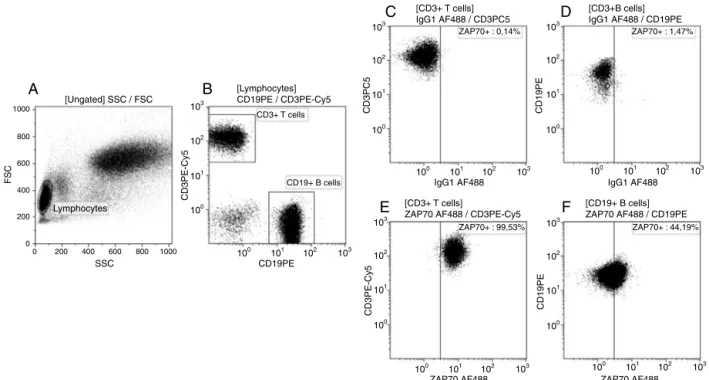 Figure 2 – Detection of ZAP-70 expression in healthy donors and chronic lymphocyte leukemia (CLL) patients