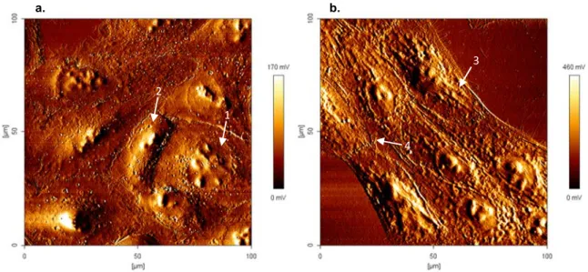Figure 3.4 – Atomic force microscopy error images (100 x 100 µm) of MDA-MB-231 (a.) (1x10 4 cells/ml) and  MCF 10A cells (b.) (1x10 5 cells/ml) (100 x 100 µm), and respective colour scales at right, in absence of PvD1