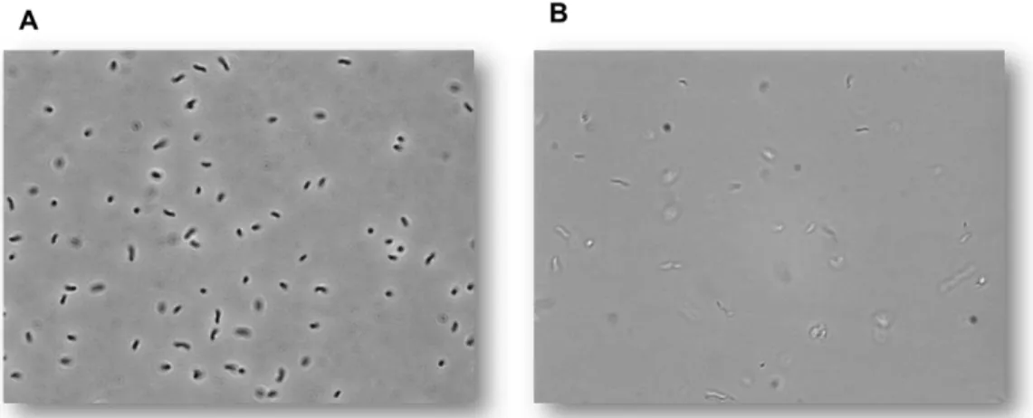 Figura 1.11: Fotos representativas das células de D. desulfuricans ATCC 27774 crescidas em meio contendo  nitrato (A) e em meio contendo sulfato (B) obtidas por microscopia eletrónica (ampliação 1000x)