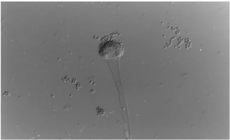 Fig. 1.1  –  Light microscopy of typical A. fumigatus sporulating structures (Latgé, 1999)