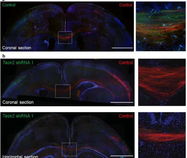 Figure 1.1.4.9. TAOK2 down-regulation affects callosal axon projection in the developing  cortex