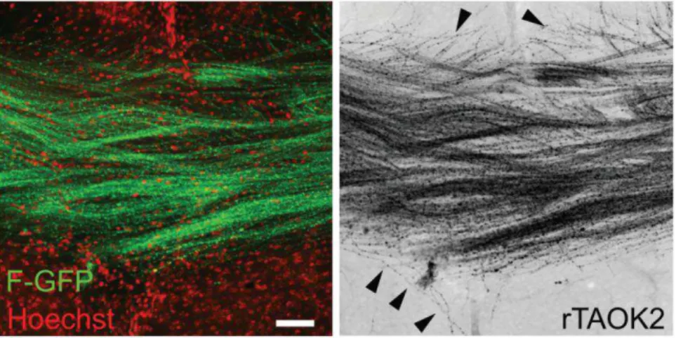 Figure 1.1.4.10. TAOK2 overexpression affects axonal projection at the corpus callosum  in the developing cortex