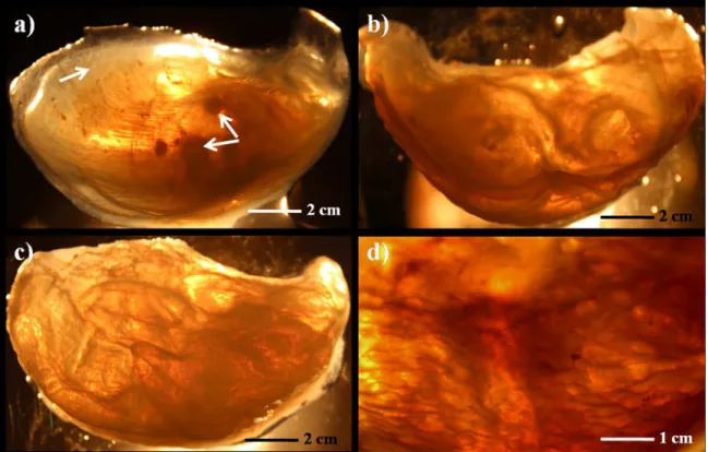 Figure 4a shows needle positioning and radiological flow  image after 4 seconds of injection