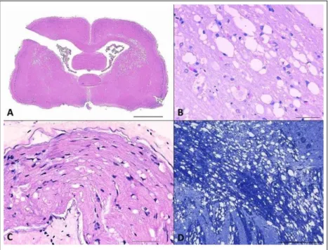 Figure 1 - Wobbly syndrome in a hedgehog. A) Transversal section of the parietal and temporal  cortex of the cerebrum with bilateral vacuolation in the white matter (Bar=2mm)