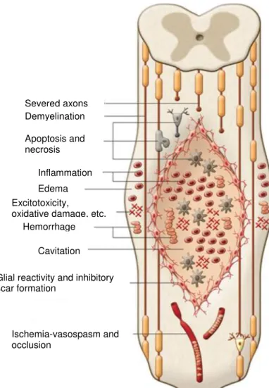 Figure  2.1  –  Pathophysiological  events occurring after  SCI,  including  the  primary, secondary  and  chronic phases