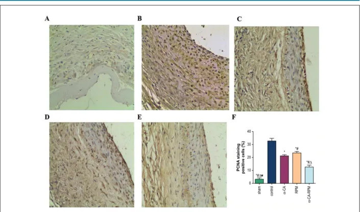 Figure 3 – α-CA-RPM decreased the proliferating index of vein graft. The vessel tissue was harvested 4 weeks after the operation, fixed with formalin, sliced to 4 μm  tissue sections and stained with the primary antibody anti-PCNA