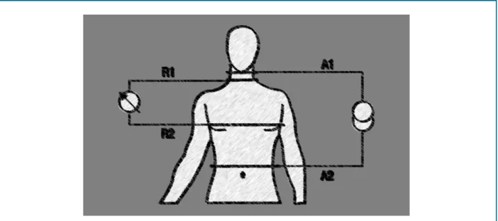 Figure 1 - Schematic illustration of impedance cardiography application, four-pole technique