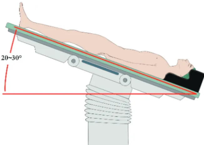 Figure 1-Trocar placement and patient position.